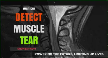 Detecting Muscle Tears: The Role of Scans