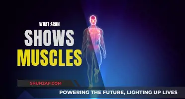 Visualizing Muscles: Scans for Detailed Insights