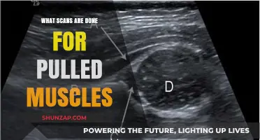 Diagnosing Pulled Muscles: Essential Scans for Accurate Assessment and Recovery