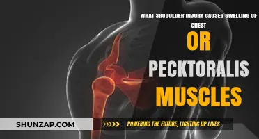 Shoulder Injury Linked to Chest and Pectoral Muscle Swelling: Causes Explained