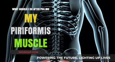 Pulled Piriformis Muscle? Recovery Tips and Exercises to Heal Fast