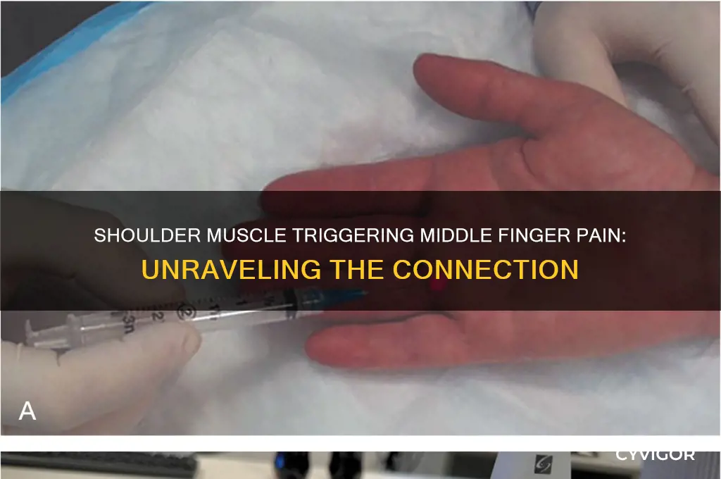 what shoulder muscle refers pain to the middle finger