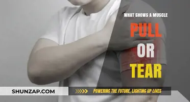 Identifying Muscle Pulls and Tears: Symptoms, Causes, and Treatment Options