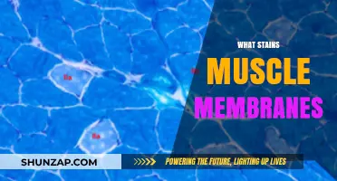 Muscle Membranes: Stains and Their Causes