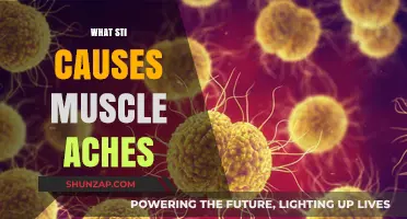 Understanding STIs: Which Infections Lead to Muscle Aches and Pain?