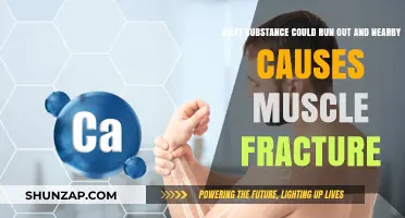 Calcium Deficiency: A Hidden Cause of Muscle Fractures Nearby