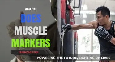 Muscle Marker Testing: What Does It Involve?