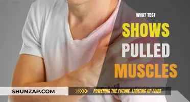 Diagnosing Pulled Muscles: Key Tests to Identify Strains and Tears