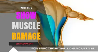 Tests That Help Detect Muscle Damage