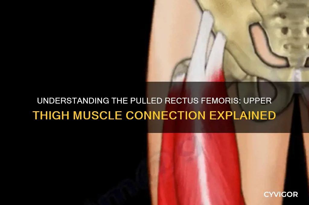 what the muscle that connects the upper thigh a pulled