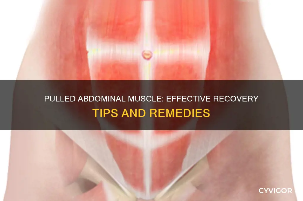 what to do for a pulled abdominal muscle