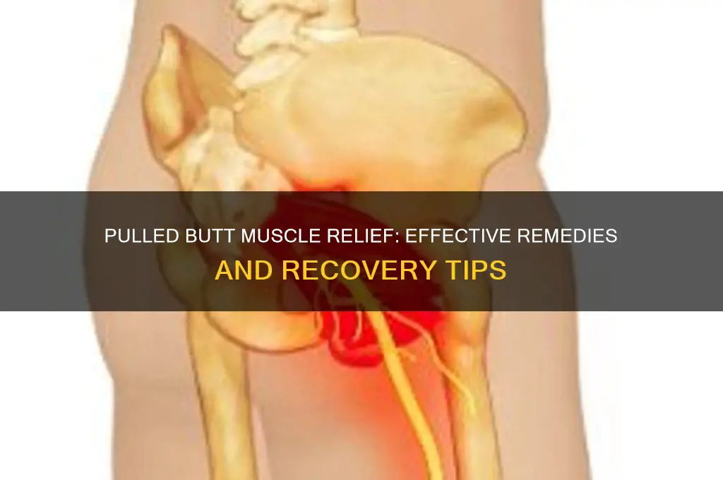 what to do for a pulled butt muscle