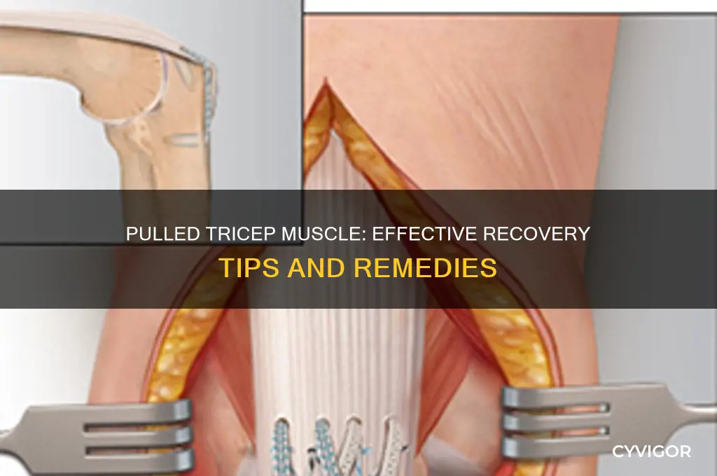 what to do for a pulled tricep muscle