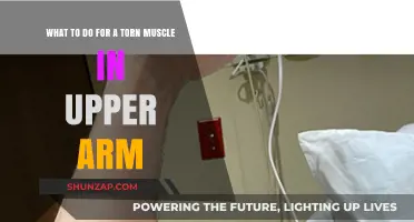Effective Recovery Tips for a Torn Upper Arm Muscle