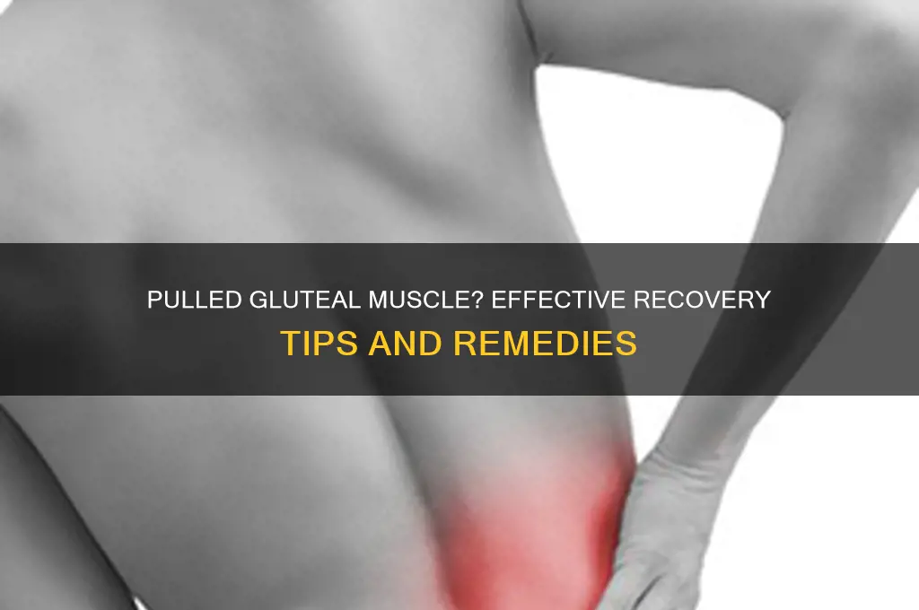 what to do if you pulled a gluteal muscle
