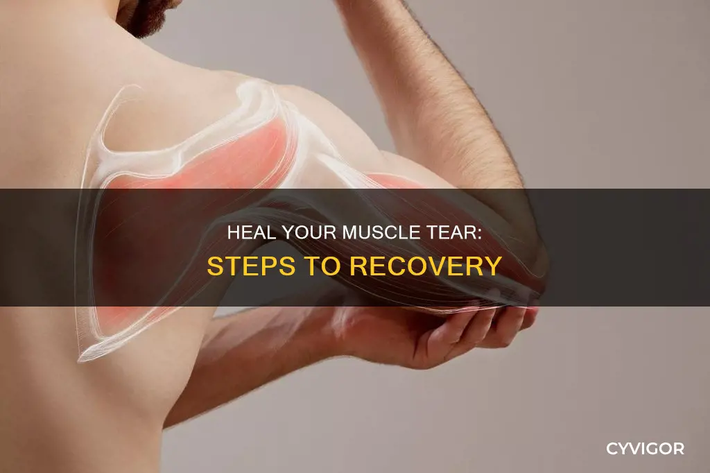 what to do muscle tear