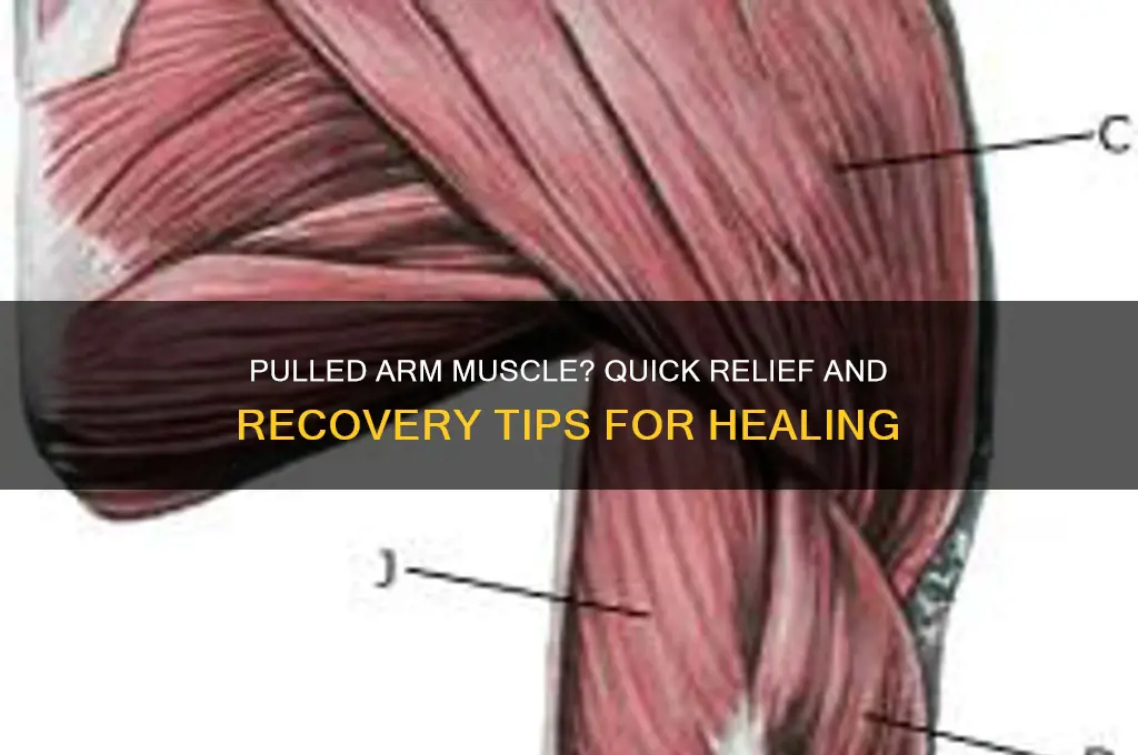 what to do when you pull a muscle in arm