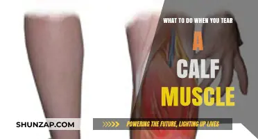 Effective Recovery Strategies for a Torn Calf Muscle Injury