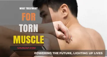 Healing a Torn Muscle: Treatment Options