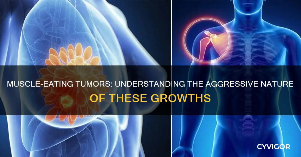 what tumor eats muscle