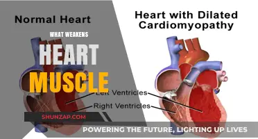 Heart Muscle Weakness: What Are the Causes?