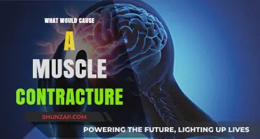 Understanding Muscle Contracture Causes: Triggers, Risks, and Prevention Strategies