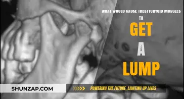 Understanding Lumps in the Stylohyoid Muscles: Causes and Concerns