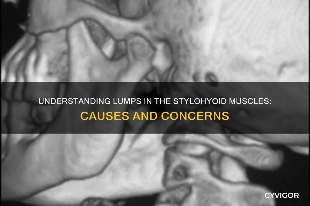 what would cause thestyohyoid muscles to get a lump