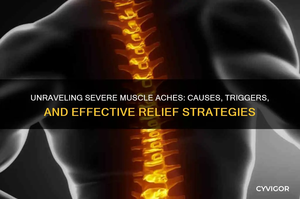 what would make you have severe muscles aches and pain