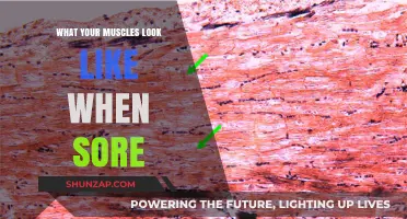 Understanding Sore Muscles: Visual Insights into Post-Workout Discomfort