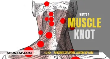 Understanding Muscle Knots: Causes, Symptoms, and Treatment Options