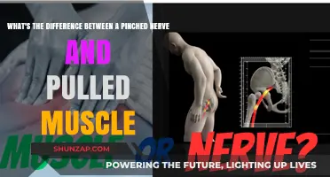 Pinched Nerve vs. Pulled Muscle: Understanding the Key Differences