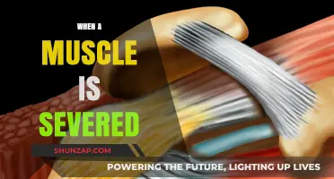 Severed Muscle: What to Do and Recovery Timeline