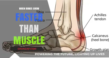Rapid Bone Growth Outpacing Muscles: Causes, Effects, and Solutions