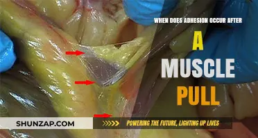 Understanding Adhesion Formation After a Muscle Pull: Timing and Recovery