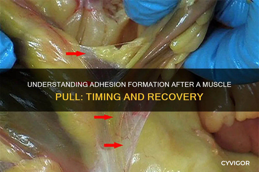 when does adhesion occur after a muscle pull