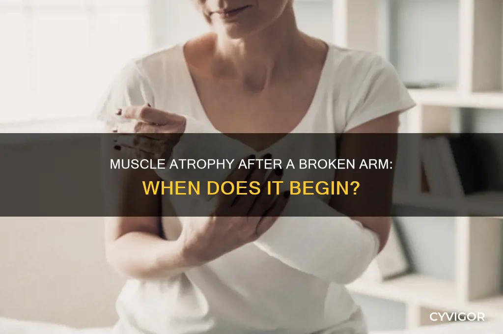 when does muscle atrophy start broken arm