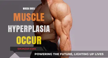 How Muscle Hyperplasia Occurs and What Triggers It