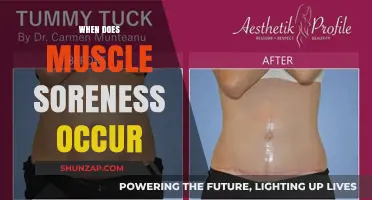 Understanding Muscle Soreness: Timing and Causes