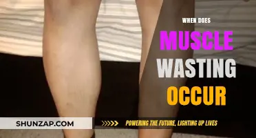 Muscle Wasting: When Does It Start?