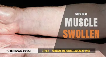 Hand Muscle Swelling: Causes and Treatment Options