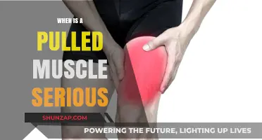 Pulled Muscle: When to Worry and Seek Medical Attention