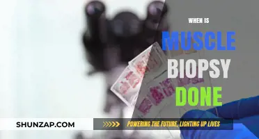 Muscle Biopsy: When is it Necessary?