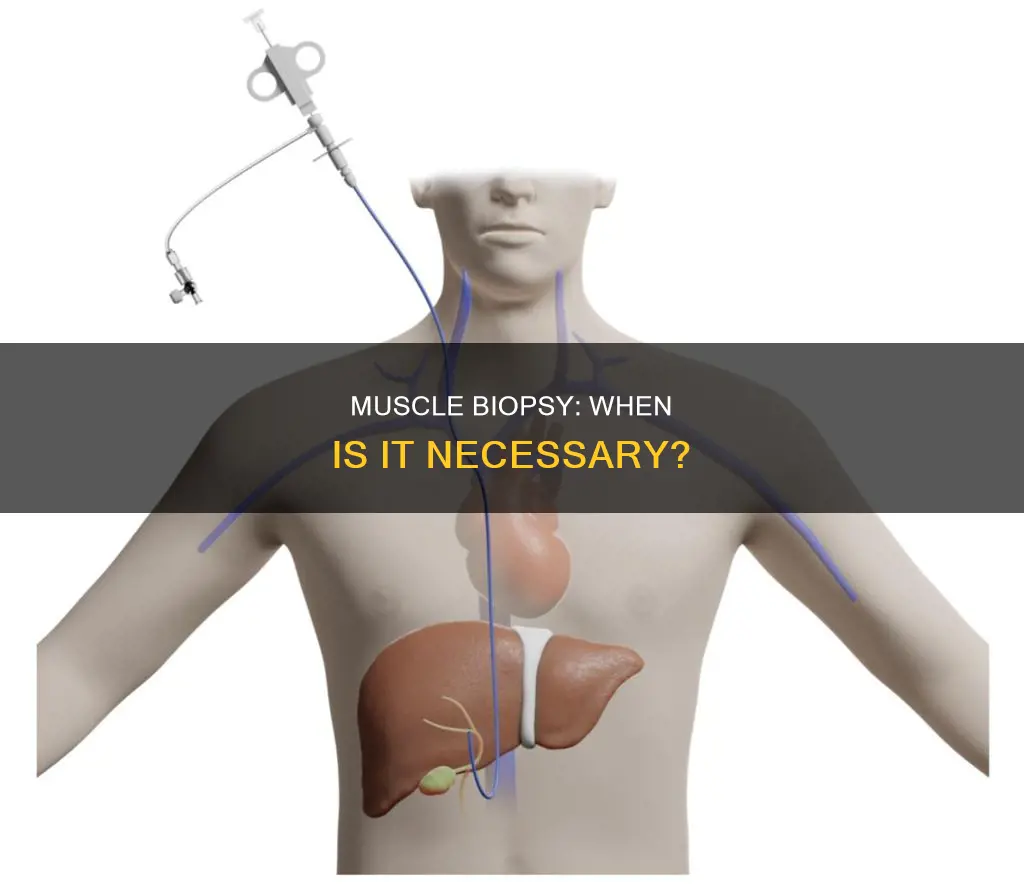 when is muscle biopsy done