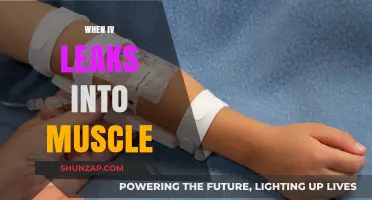 Muscle Leaks: Understanding IV Complications