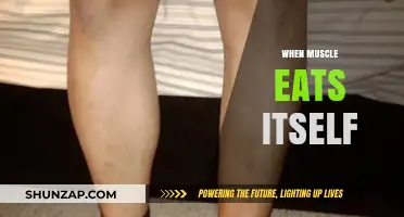Muscle Wasting: When Muscles Eat Themselves