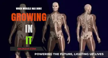 Bone Growth in Muscle Tissue: Causes, Symptoms, and Treatment Options