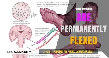 Muscle Flex: The Permanent State of Tension