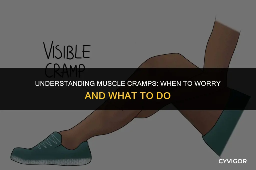 when should i be concerned about muscle cramping