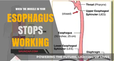 Esophageal Muscle Failure: Causes, Symptoms, and Treatment Options Explained